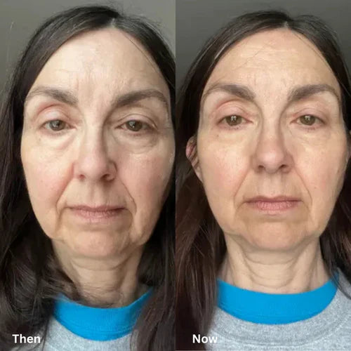 Before and After 3
