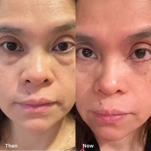 Before and After 4