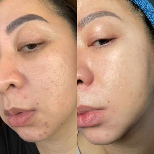 Before and After 5